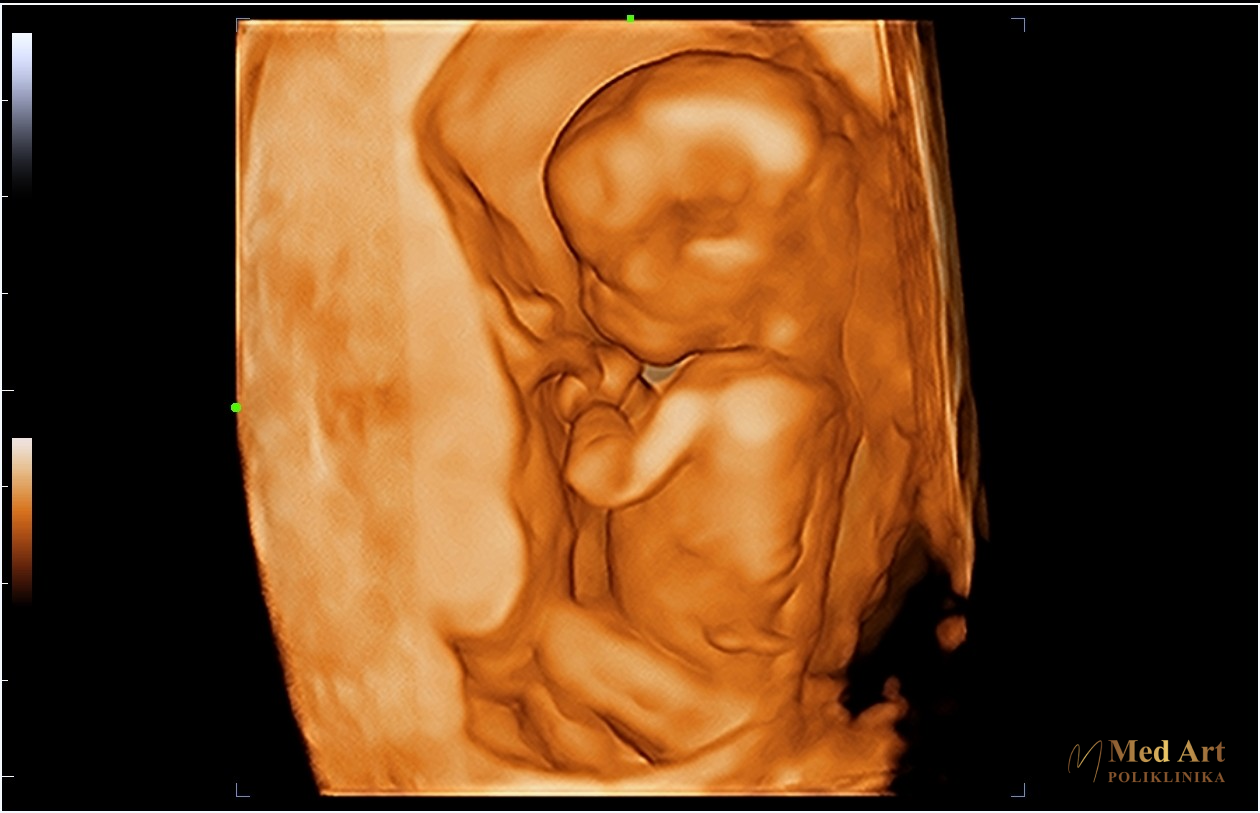 Beba 14 tjedana 2 dana