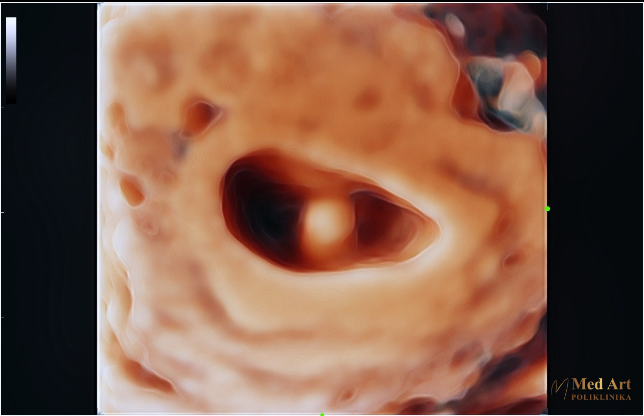 Beba 6 tjedana 6 dana